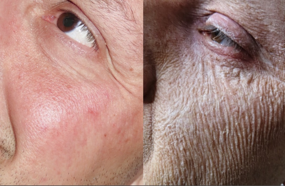 Ola Age Transformation