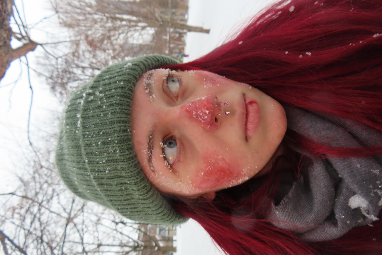 Extreme Frostbite