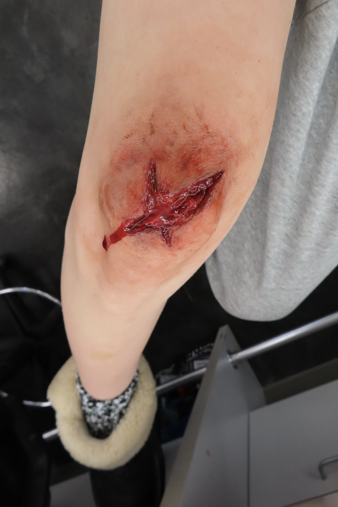 Torn Flesh Prosthetic